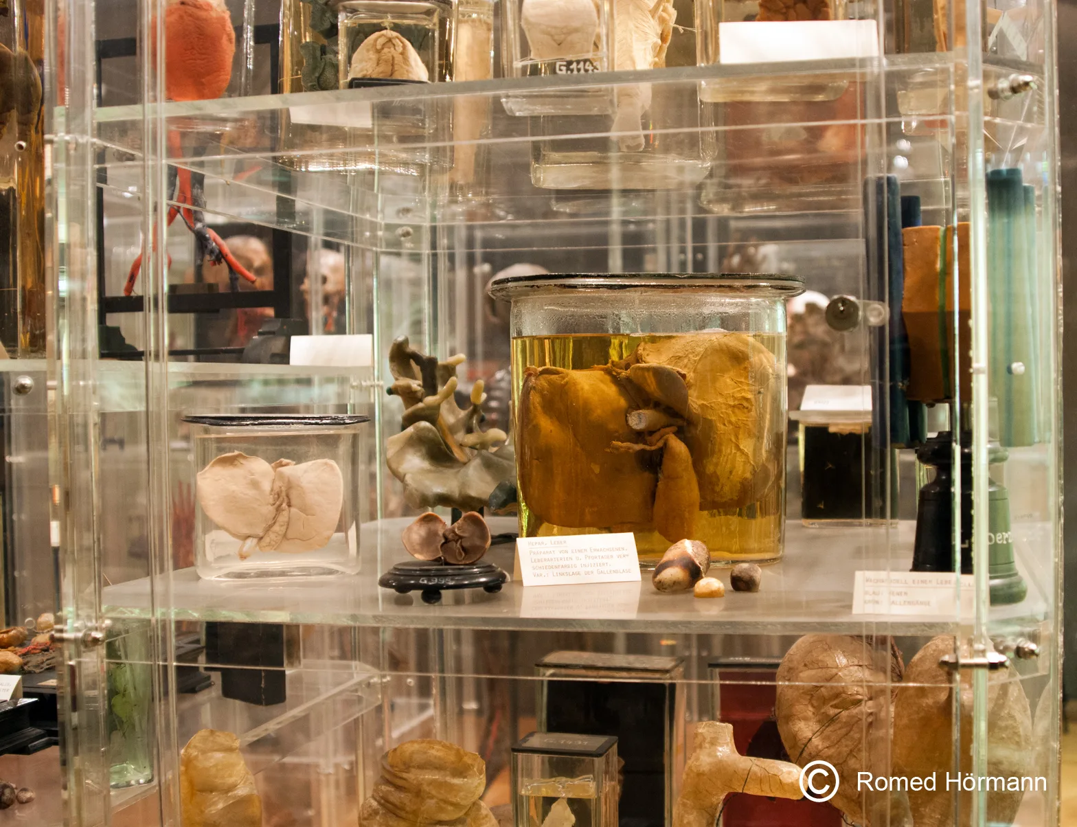 Main view at Anatomisches Museum / Medizinische Universität Innsbruck Innsbruck — travel photo