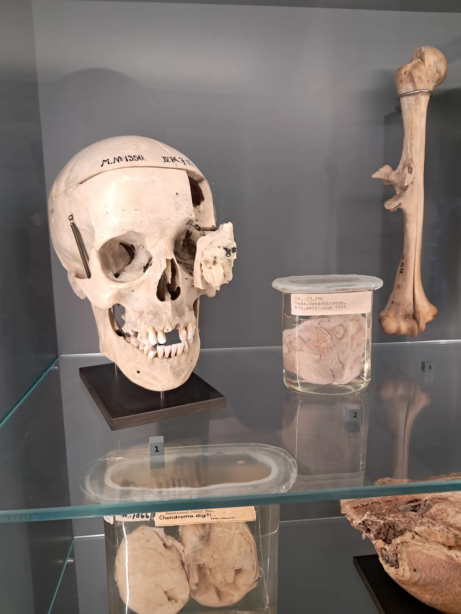 Main view at Pathological-anatomical collection in the Narrenturm Vienna — travel photo
