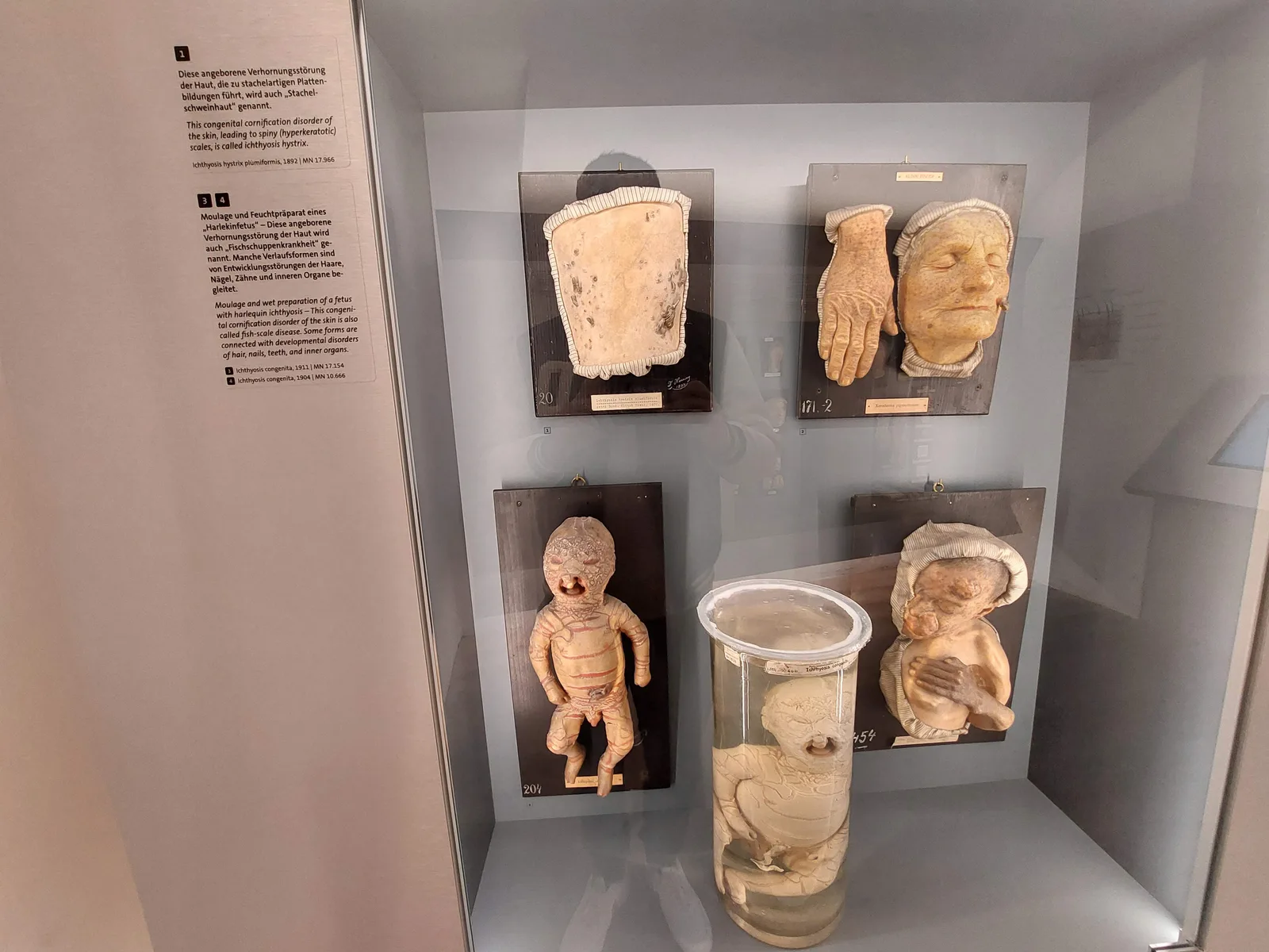 Details at Pathological-anatomical collection in the Narrenturm Vienna — travel photo