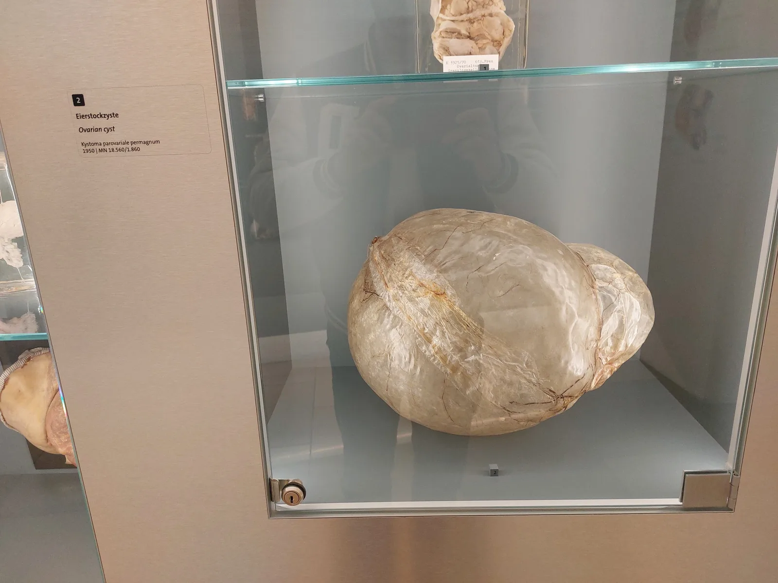 Atmosphere at Pathological-anatomical collection in the Narrenturm Vienna — travel photo