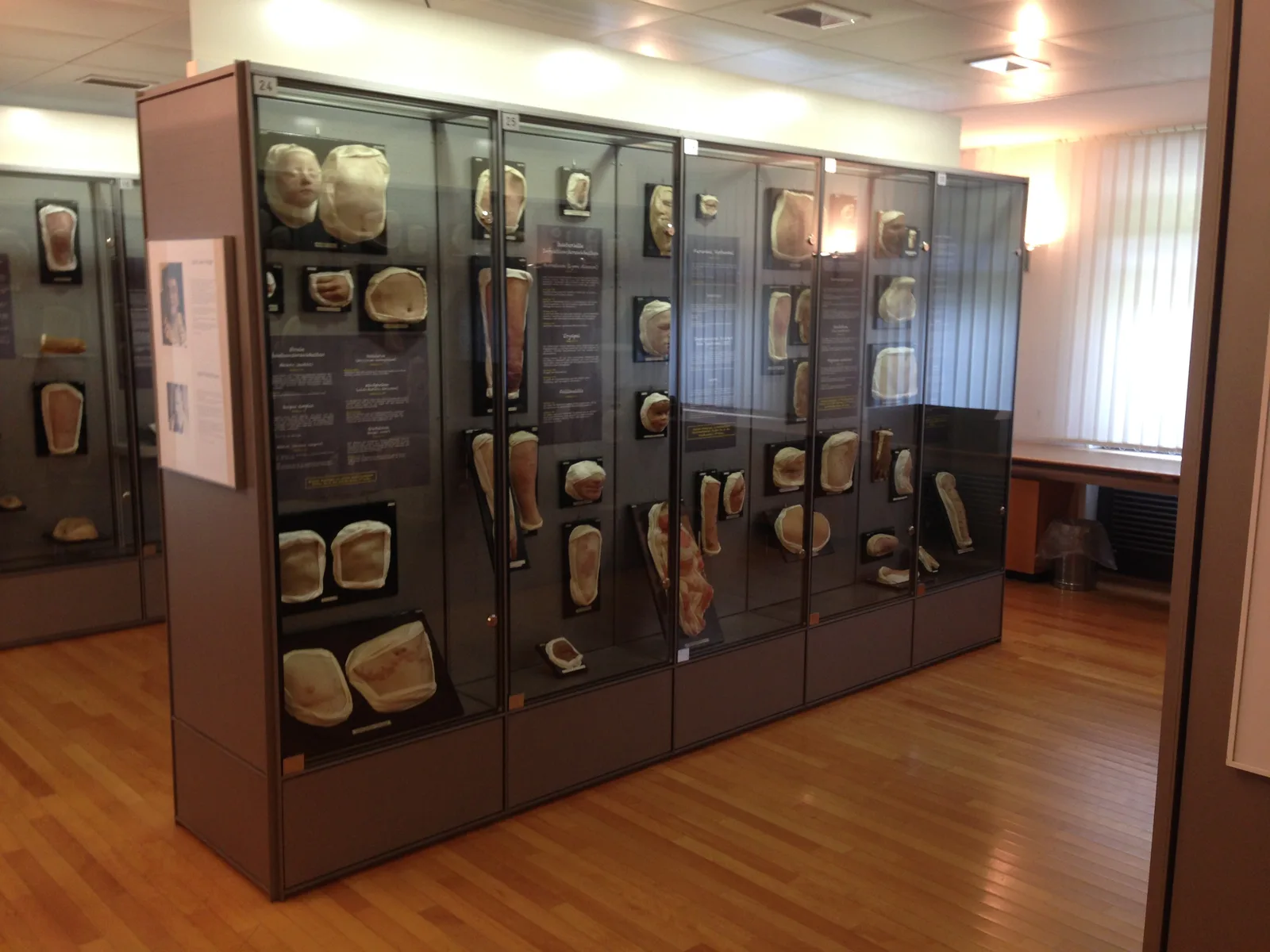 Details at Moulagen museum Zurich — travel photo